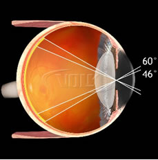 20D Double Aspheric Lens 52mm