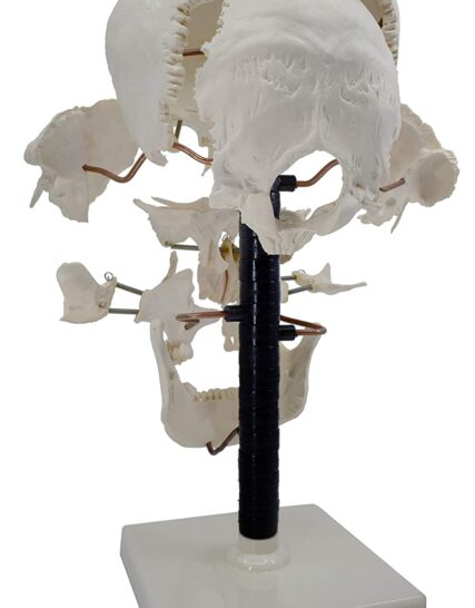 Beauchene Exploded Skull Model