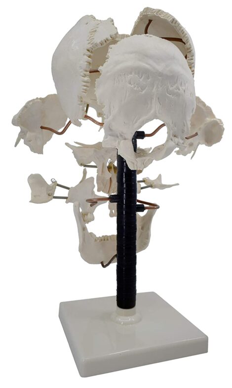 Beauchene Exploded Skull Model