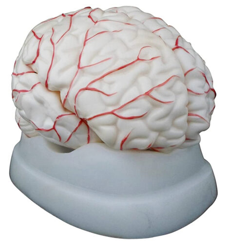 Human Brain with Arteries