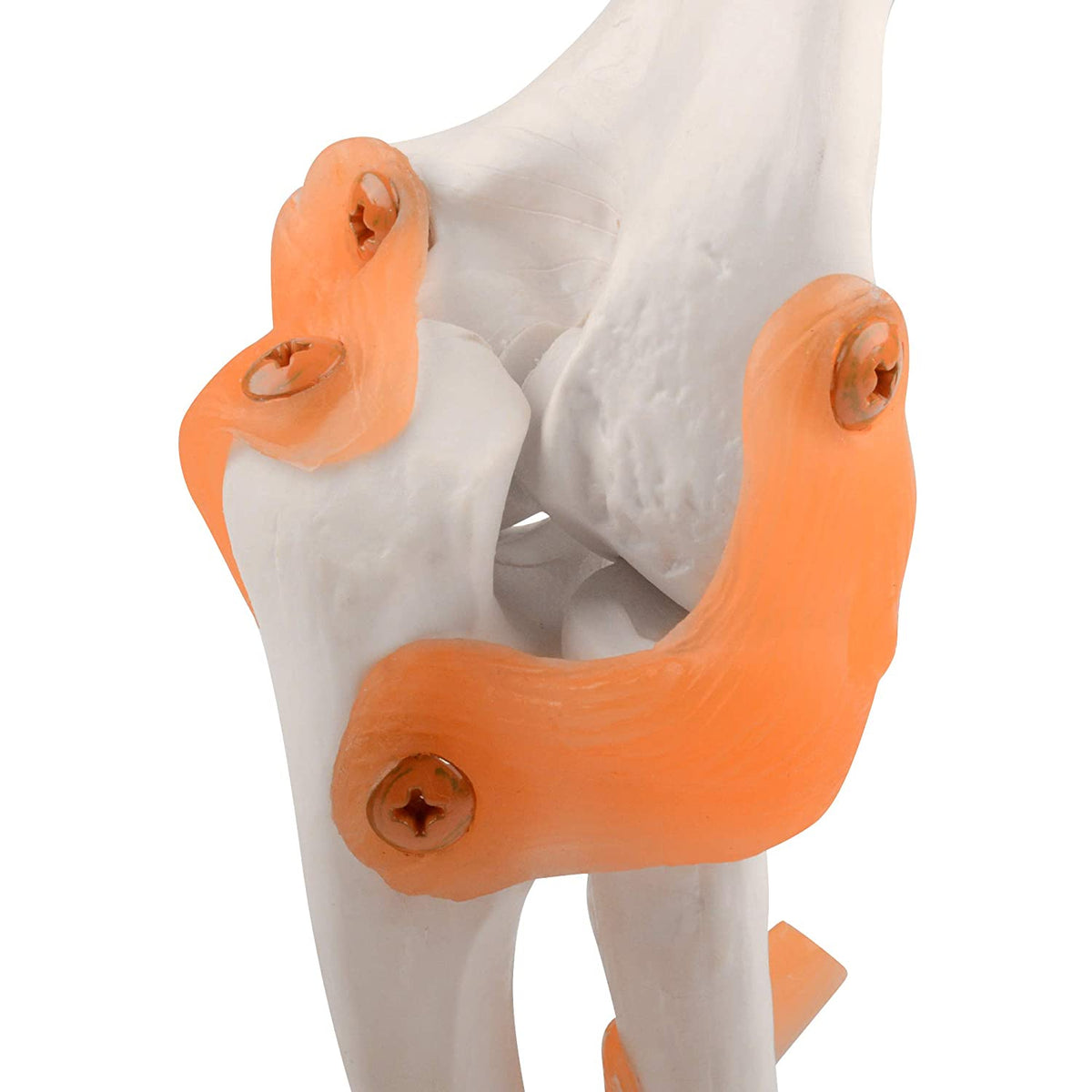 Elbow Joint Model